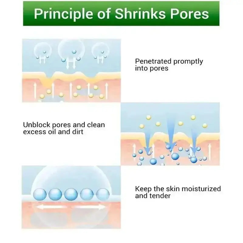 Salicylic Acid Pore Clearing Cream