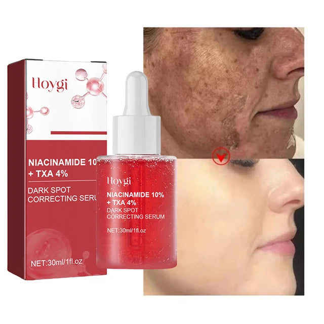 Dark Correcting Essence Serum