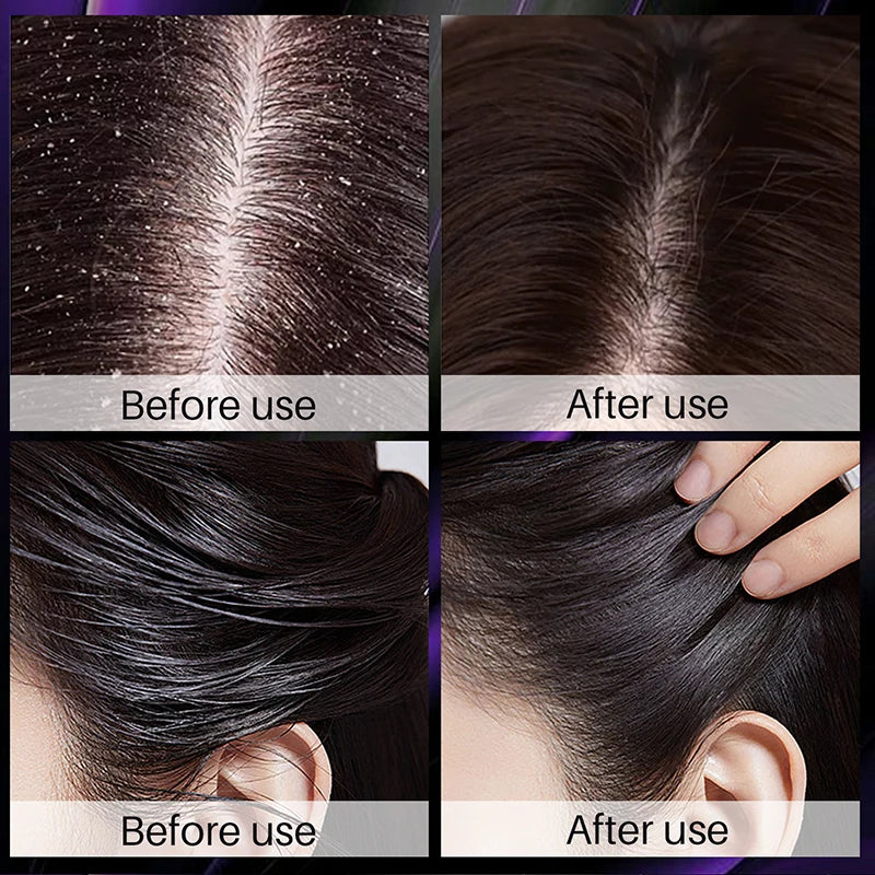 Hair Growth & Thickening Shampoo – Rosemary & Onion