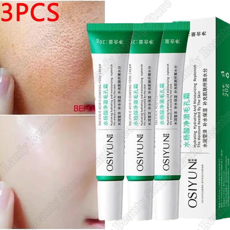 Salicylic Acid Pore Clearing Cream