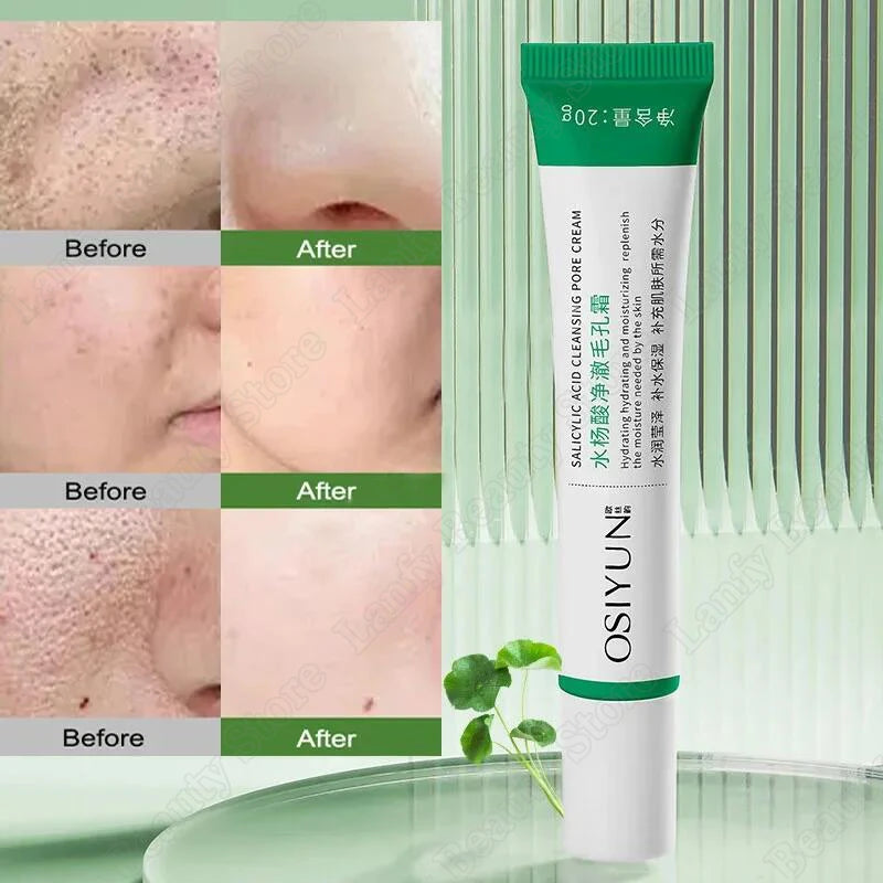Salicylic Acid Pore Clearing Cream