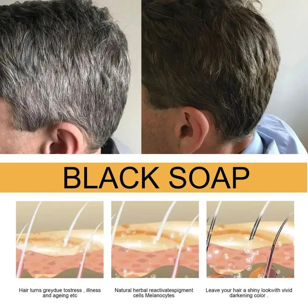 Polygonum Black Hair Shampoo Bar – Darkening & Repair Soap for Gray Hair (Unisex)