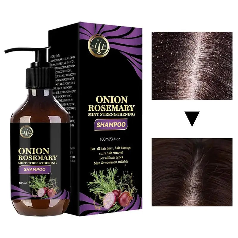 Hair Growth & Thickening Shampoo – Rosemary & Onion