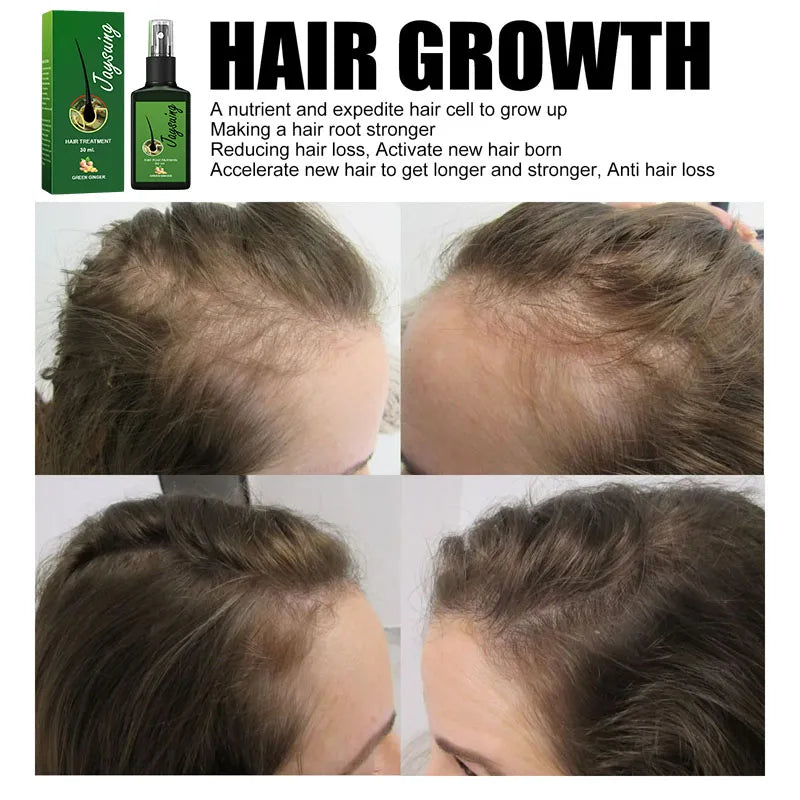 Fast Hair Growth Serum Spray – Anti Hair Loss Scalp Treatment