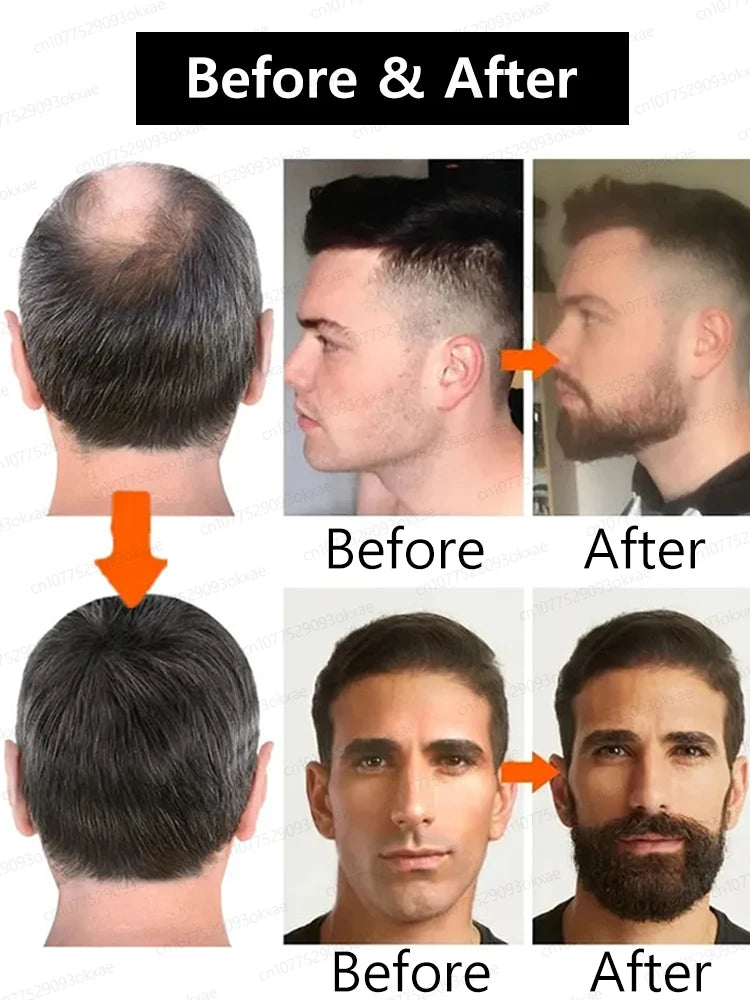 2025 Beard & Hair Growth Essence