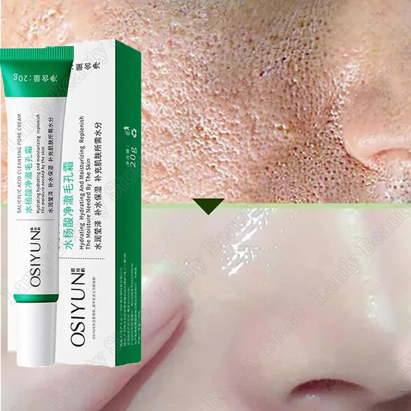 Salicylic Acid Pore Clearing Cream