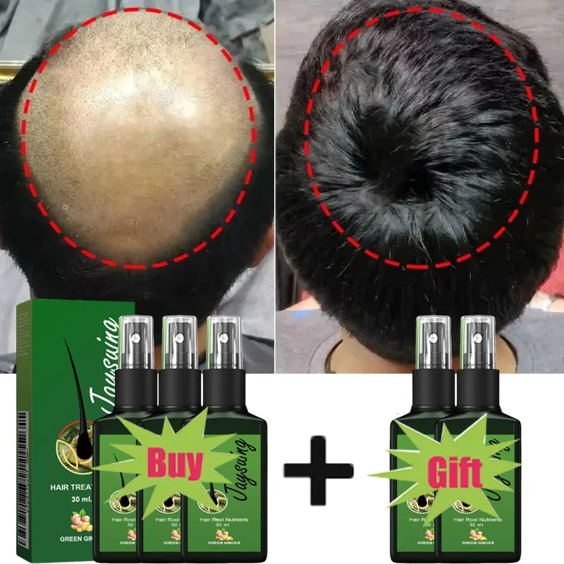 Fast Hair Growth Serum Spray – Anti Hair Loss Scalp Treatment