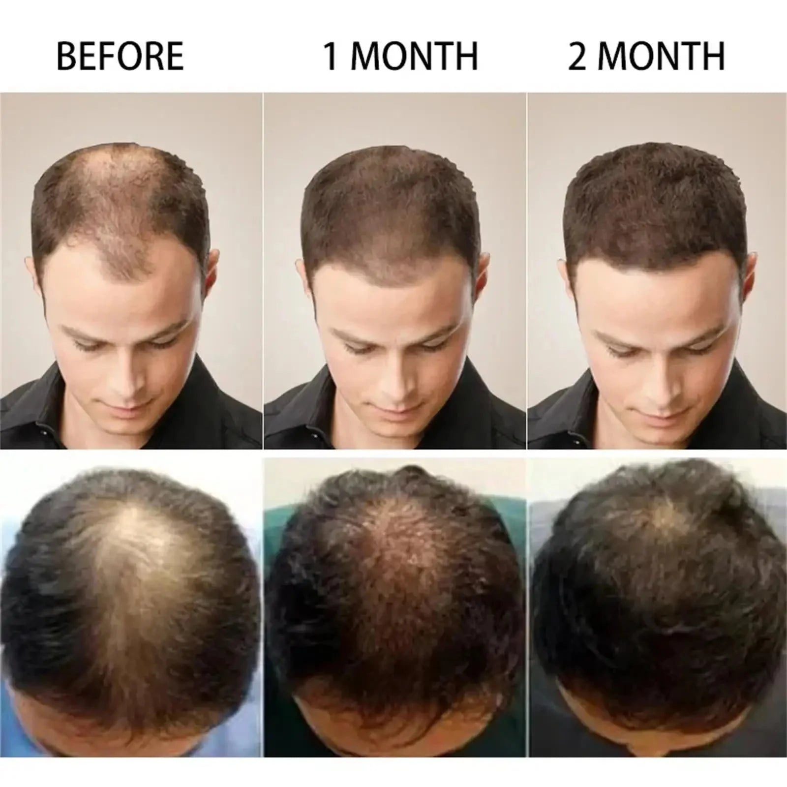 7 Days Batana Hair Growth Serum
