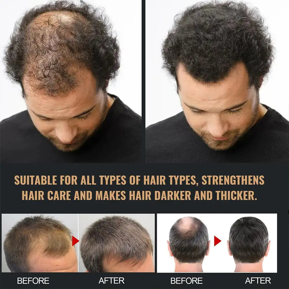 2PCS Hair Regrowth & Thickening Shampoo Set