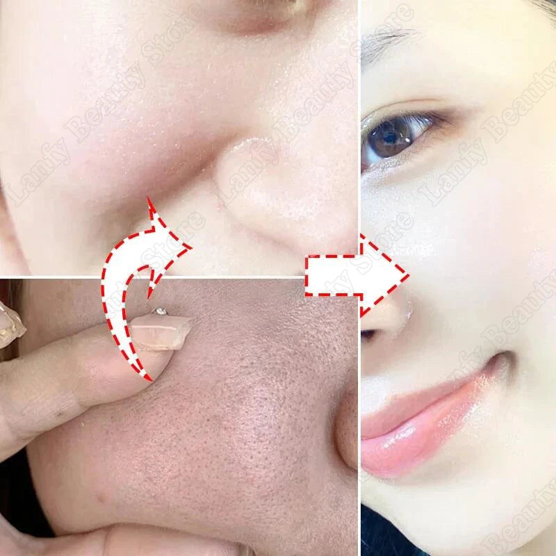 Salicylic Acid Pore Clearing Cream