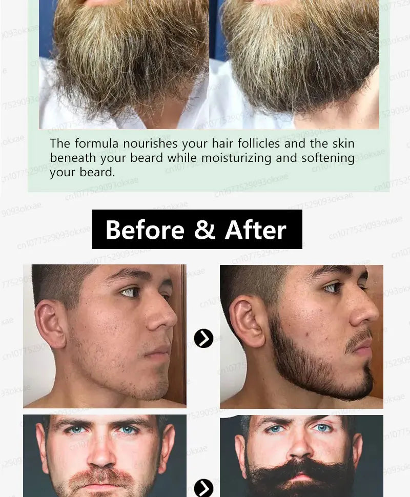 2025 Beard & Hair Growth Essence