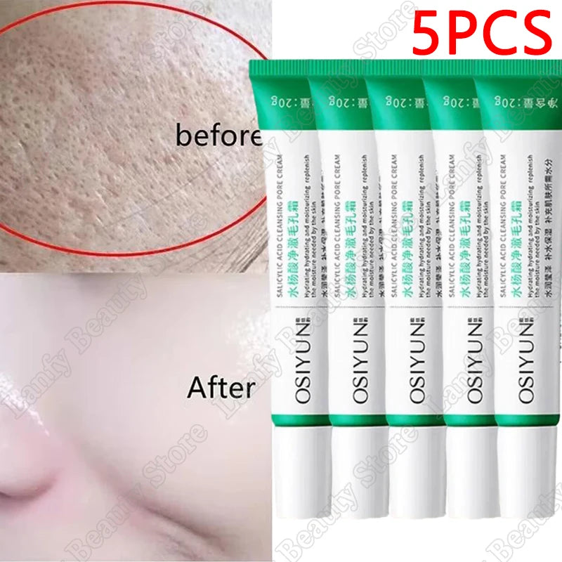 Salicylic Acid Pore Clearing Cream