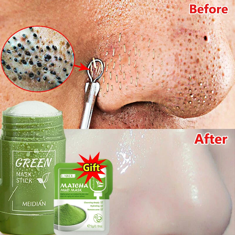 Green Tea Blackhead Removal Face Stick