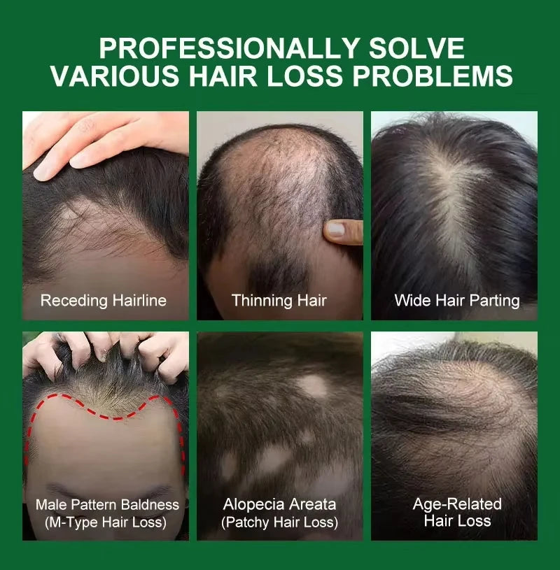 Fast Hair Growth Serum Spray – Anti Hair Loss Scalp Treatment