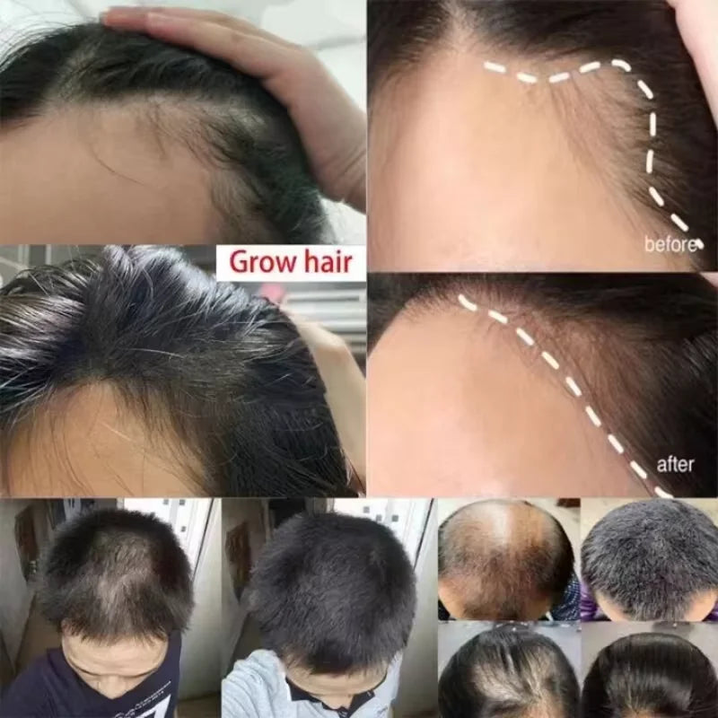 Fast Hair Growth Serum Spray – Anti Hair Loss Scalp Treatment