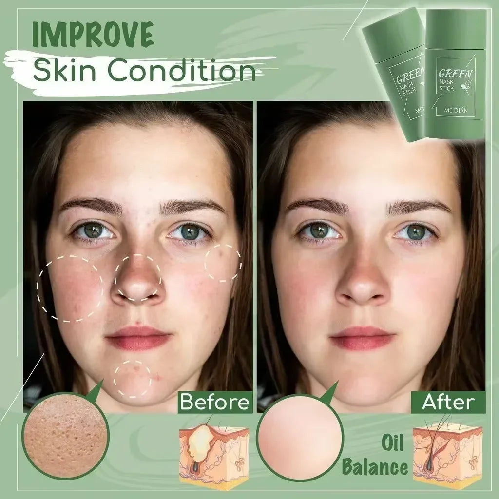 Green Tea Blackhead Removal Face Stick