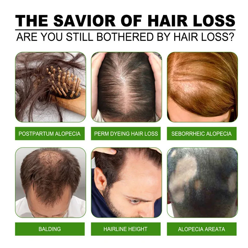 Fast Hair Growth Serum Spray – Anti Hair Loss Scalp Treatment