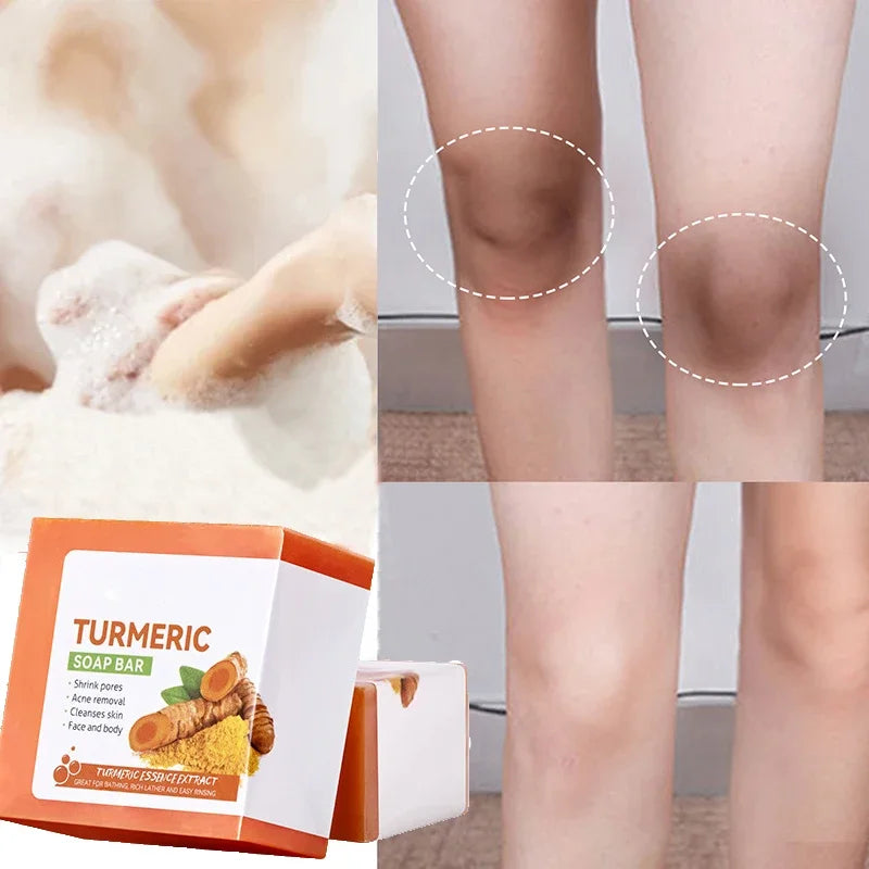 Handmade Turmeric Soap – Brightening & Skin-Clearing Body Cleanser