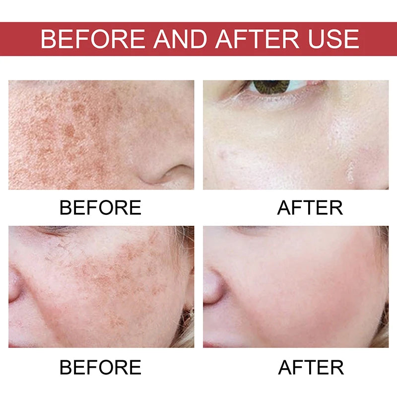 Dark Correcting Essence Serum