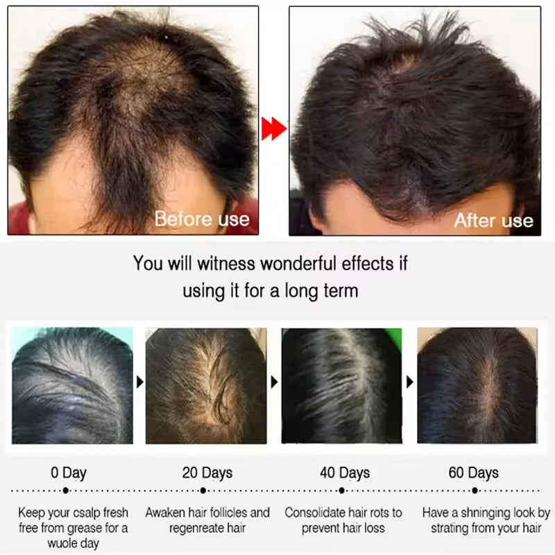 7 Days Batana Hair Growth Serum