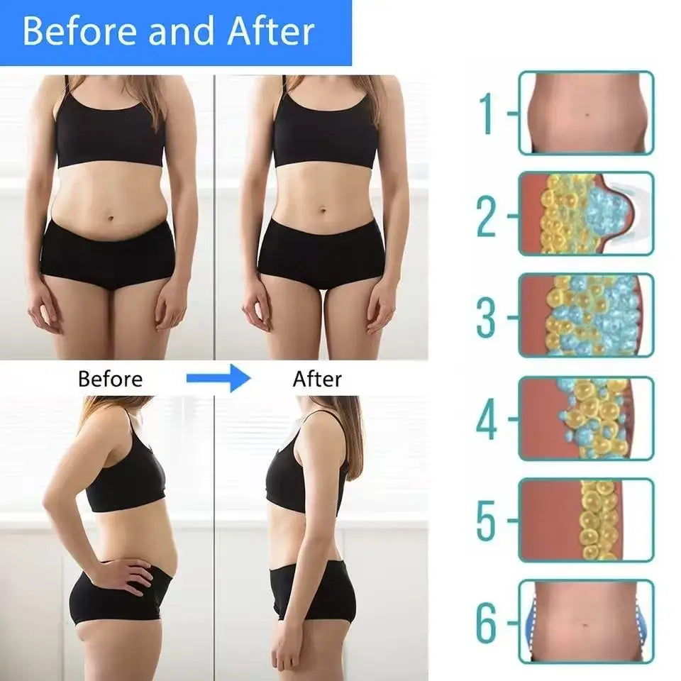 Cryotherapy Fat Freeze & Cellulite Massager
