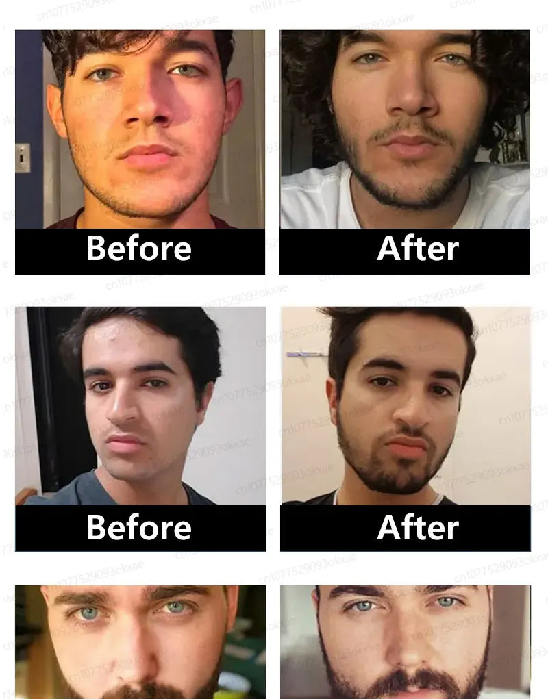 2025 Beard & Hair Growth Essence