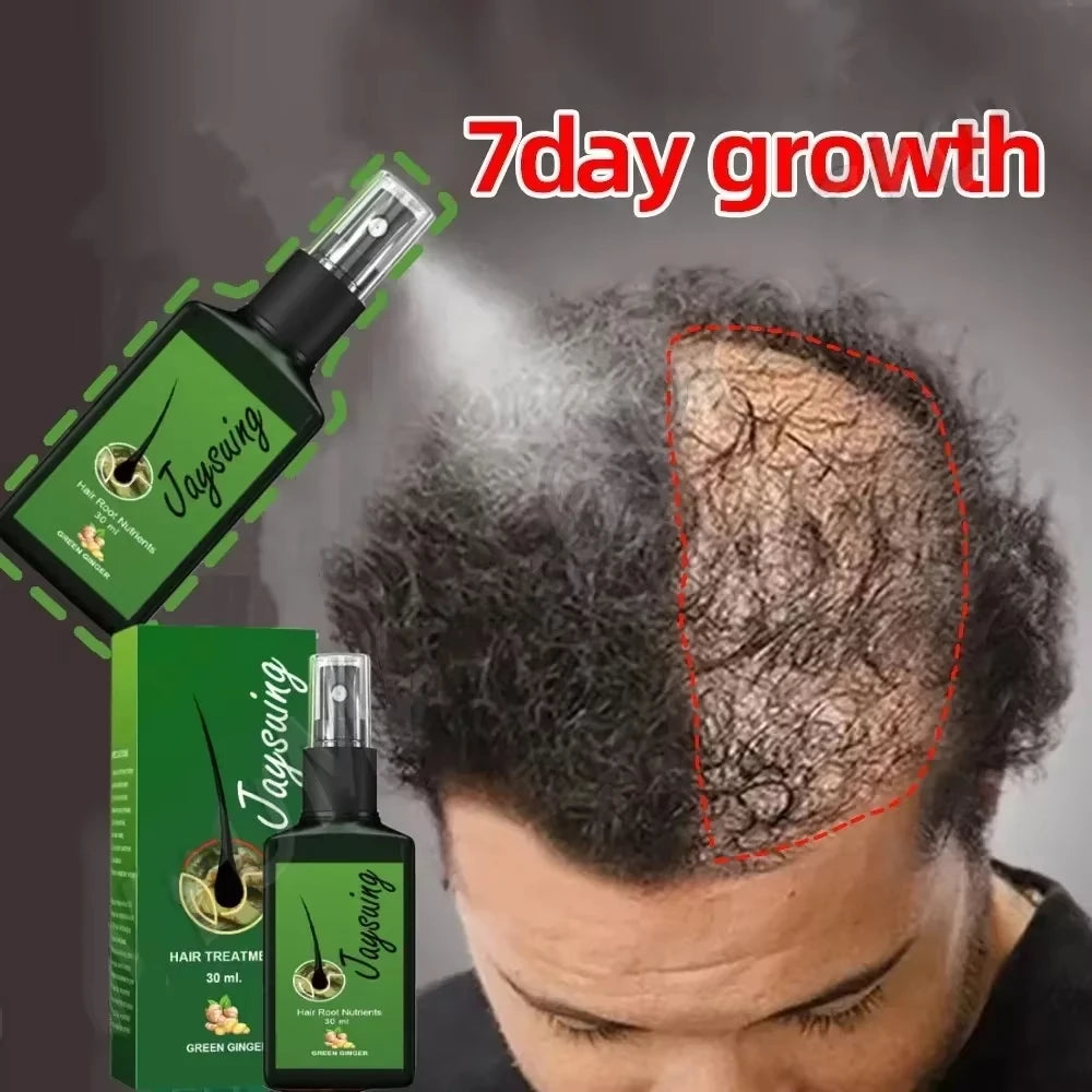 Fast Hair Growth Serum Spray – Anti Hair Loss Scalp Treatment