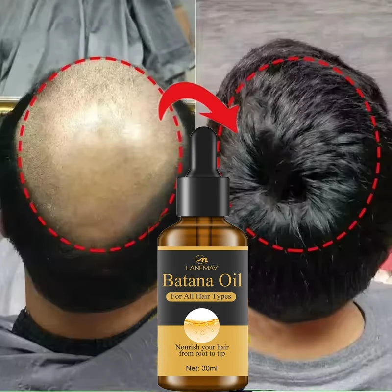 7 Days Batana Hair Growth Serum