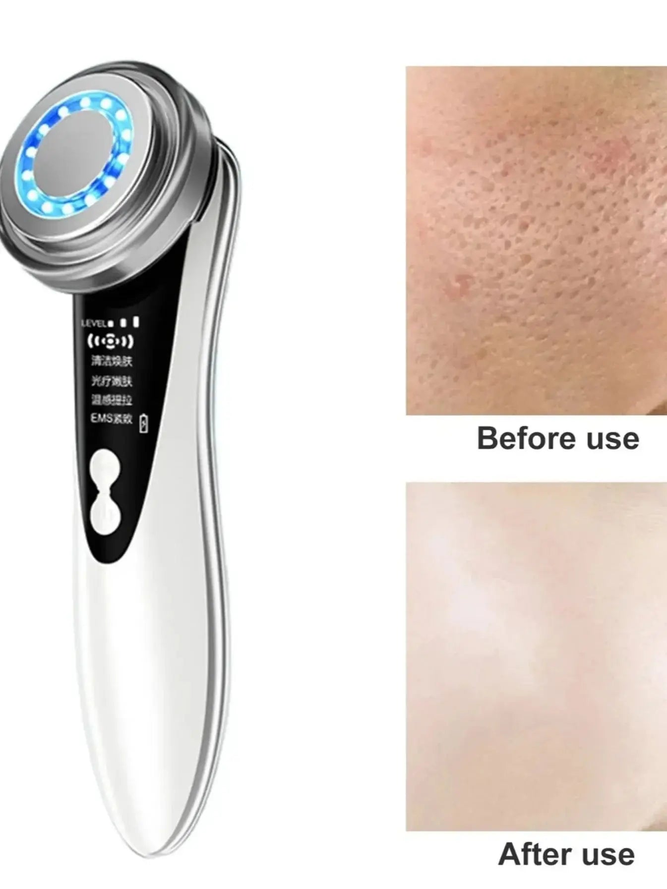 5-in-1 Facial Massager – LED Therapy, Eye Care & Skin Smoothing (USB Rechargeable)