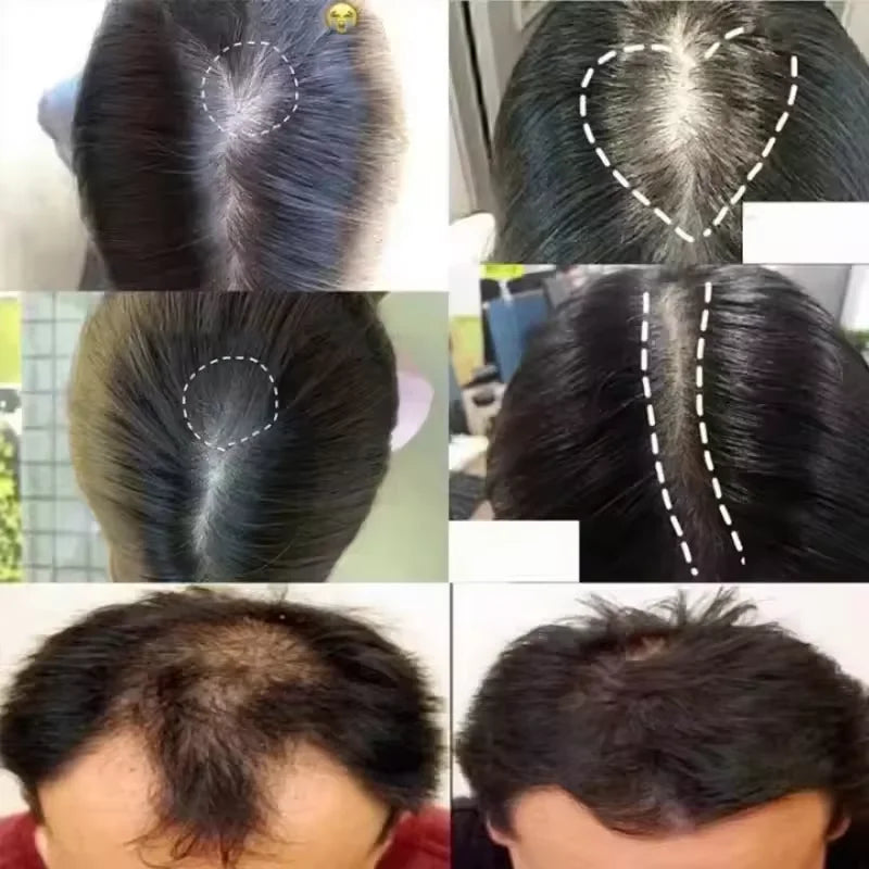 7 Days Batana Hair Growth Serum