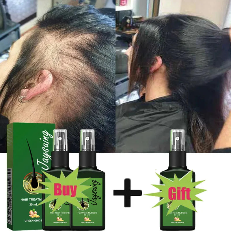 Fast Hair Growth Serum Spray – Anti Hair Loss Scalp Treatment