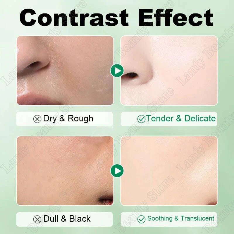 Salicylic Acid Pore Clearing Cream