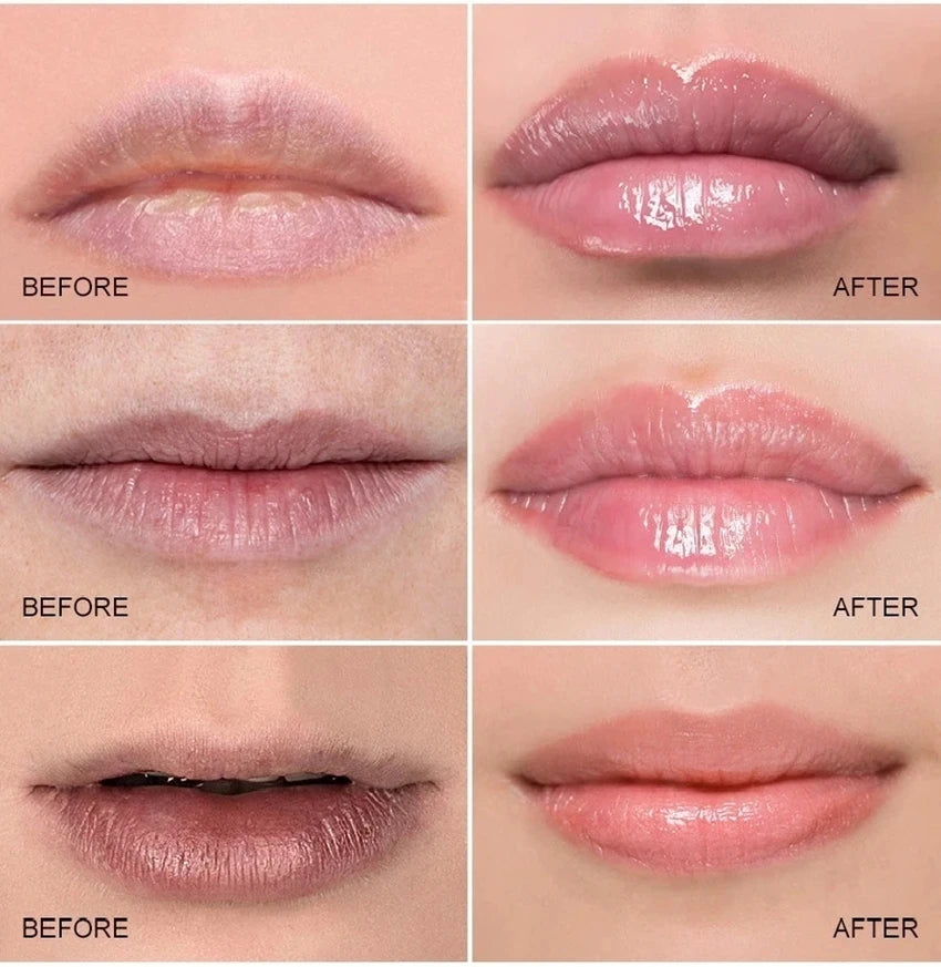 Lemon Ginger Turmeric Lip Balm & Exfoliating Mask