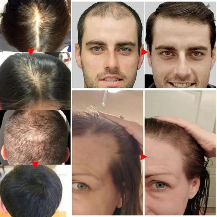 7 Days Batana Hair Growth Serum