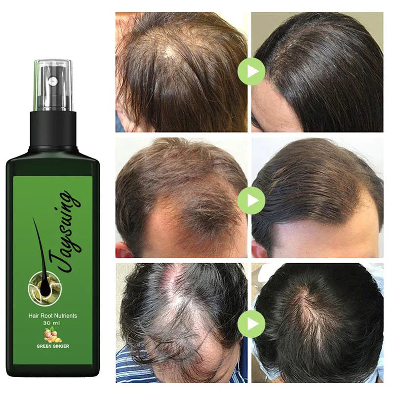 Fast Hair Growth Serum Spray – Anti Hair Loss Scalp Treatment