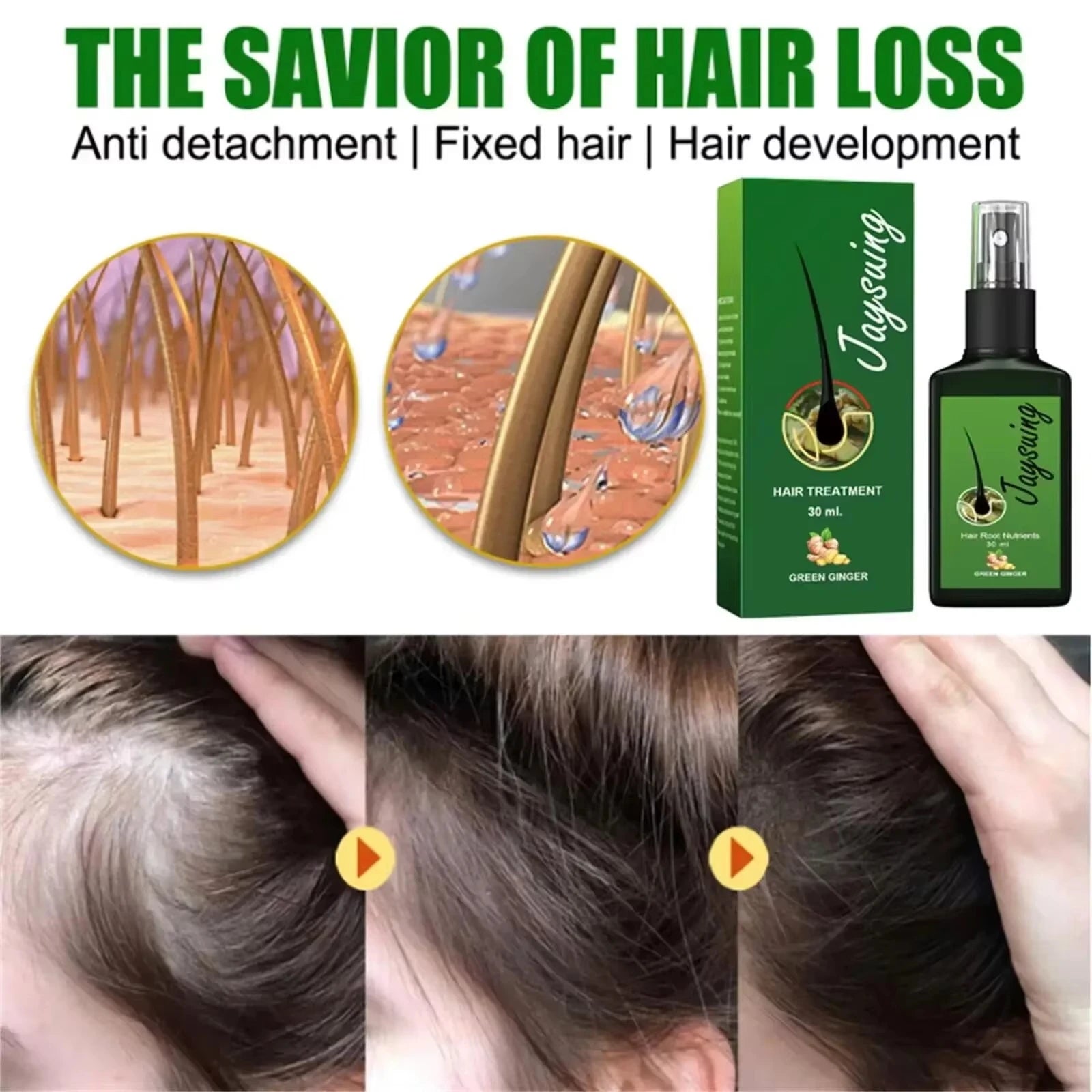 Fast Hair Growth Serum Spray – Anti Hair Loss Scalp Treatment