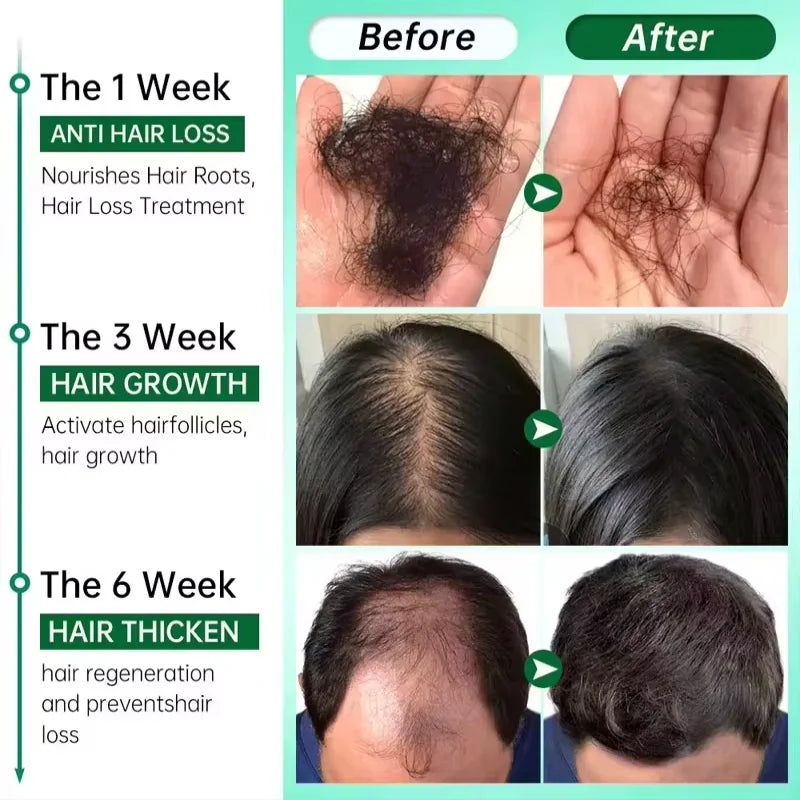 Fast Hair Growth Serum Spray – Anti Hair Loss Scalp Treatment