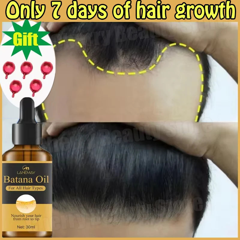 7 Days Batana Hair Growth Serum