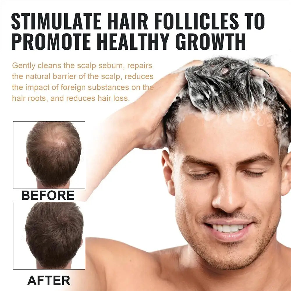 2PCS Hair Regrowth & Thickening Shampoo Set