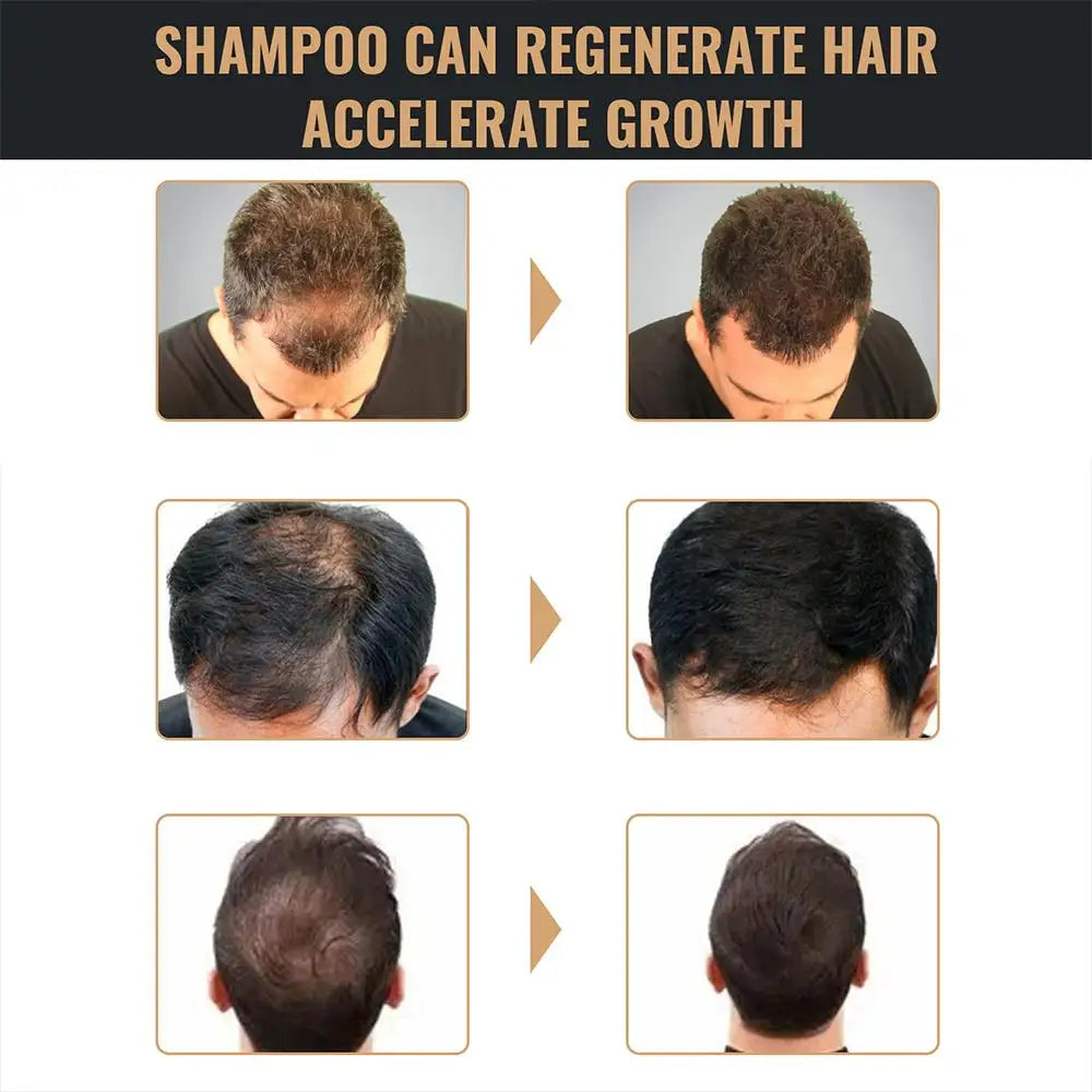 2PCS Hair Regrowth & Thickening Shampoo Set