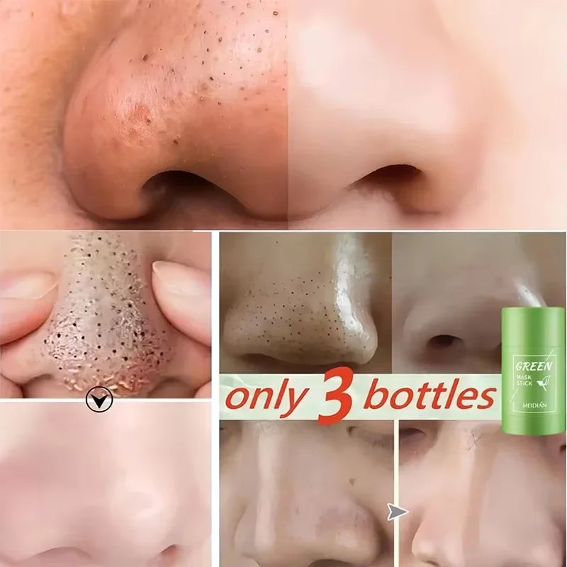 Green Tea Blackhead Removal Face Stick