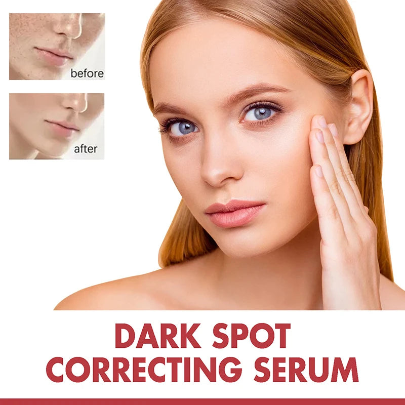 Dark Correcting Essence Serum