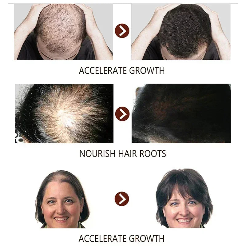 7-Day Ginger Hair Growth Serum