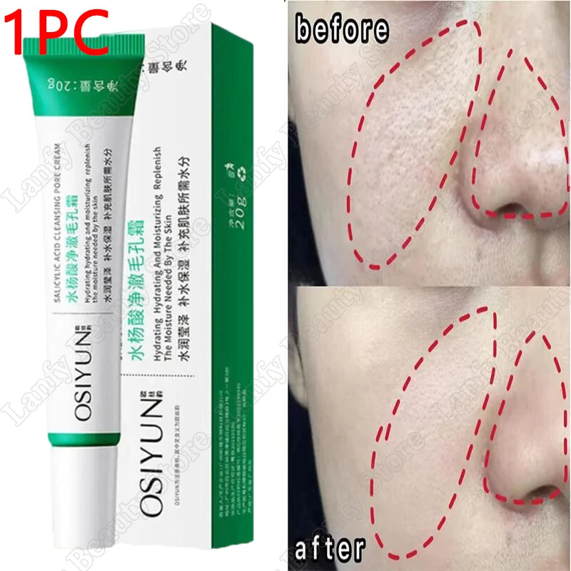 Salicylic Acid Pore Clearing Cream