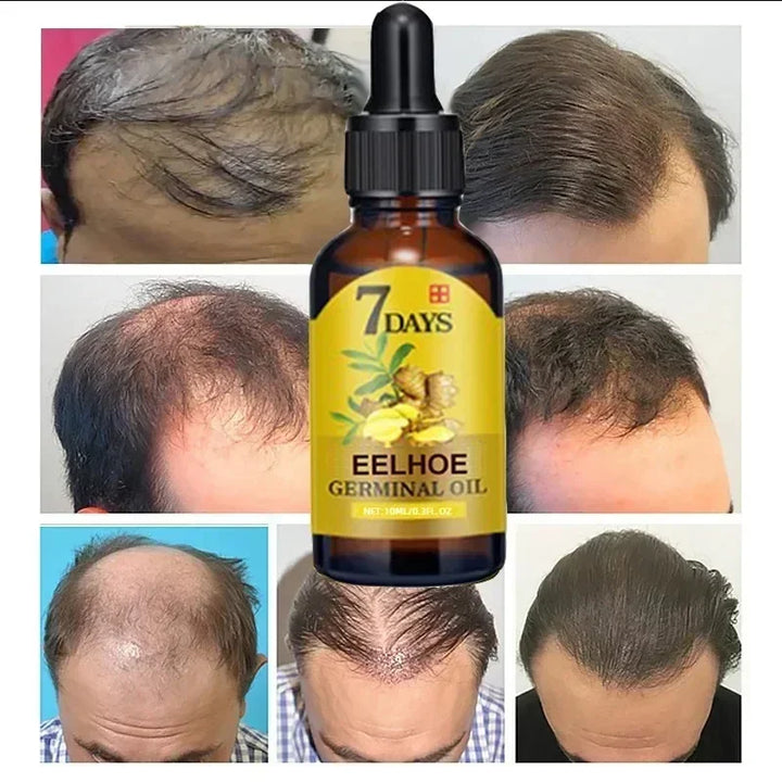 7-Day Ginger Hair Growth Serum