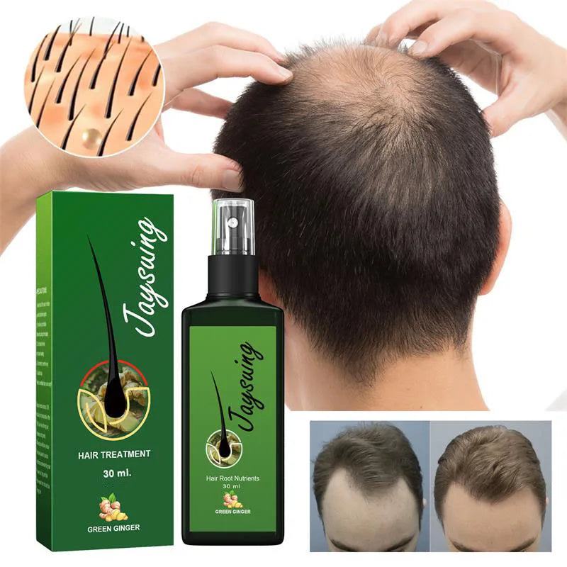 Fast Hair Growth Serum Spray – Anti Hair Loss Scalp Treatment
