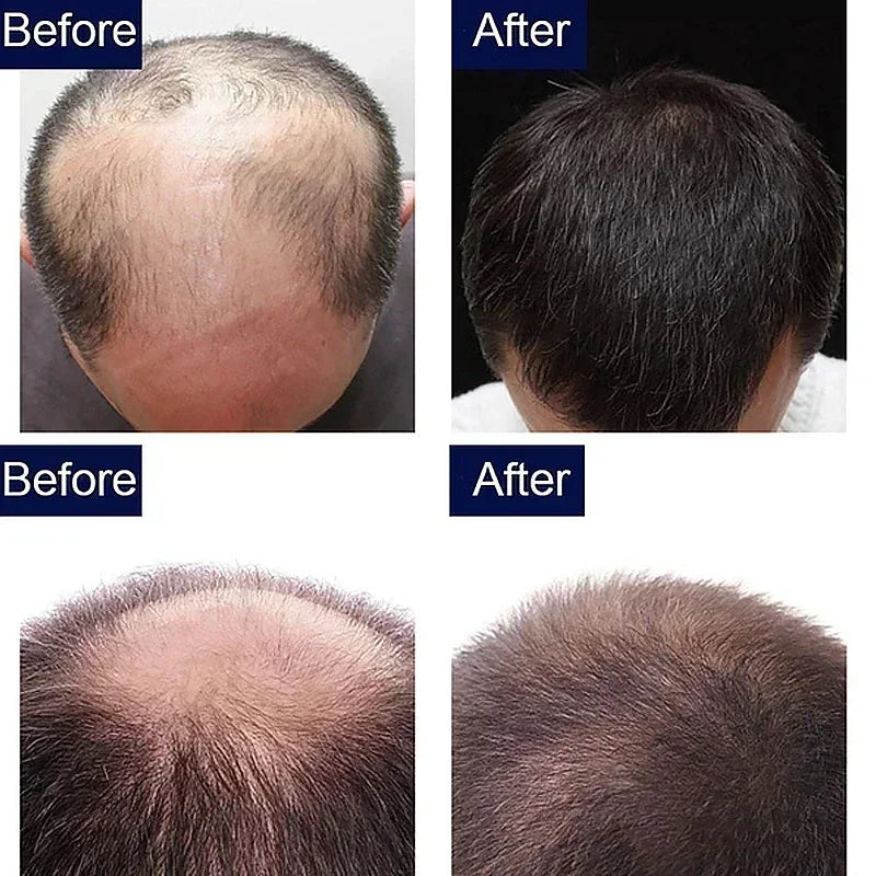7-Day Ginger Hair Growth Serum