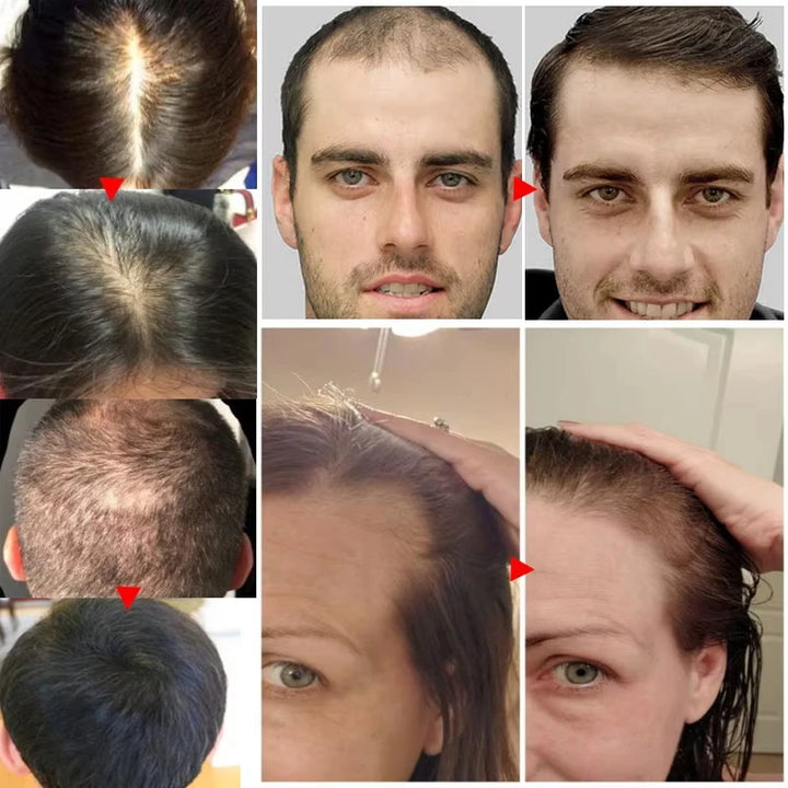 Fast Hair Growth Serum Spray – Anti Hair Loss Scalp Treatment