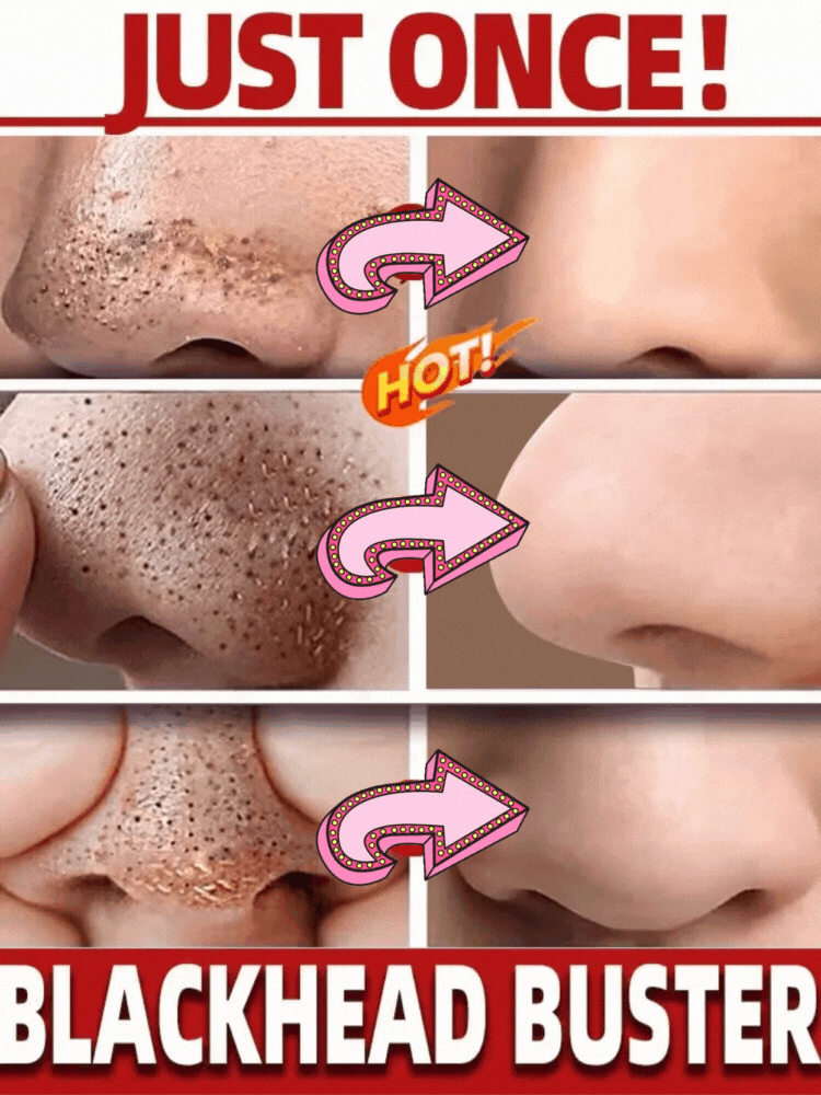 Green Tea Blackhead Removal Face Stick