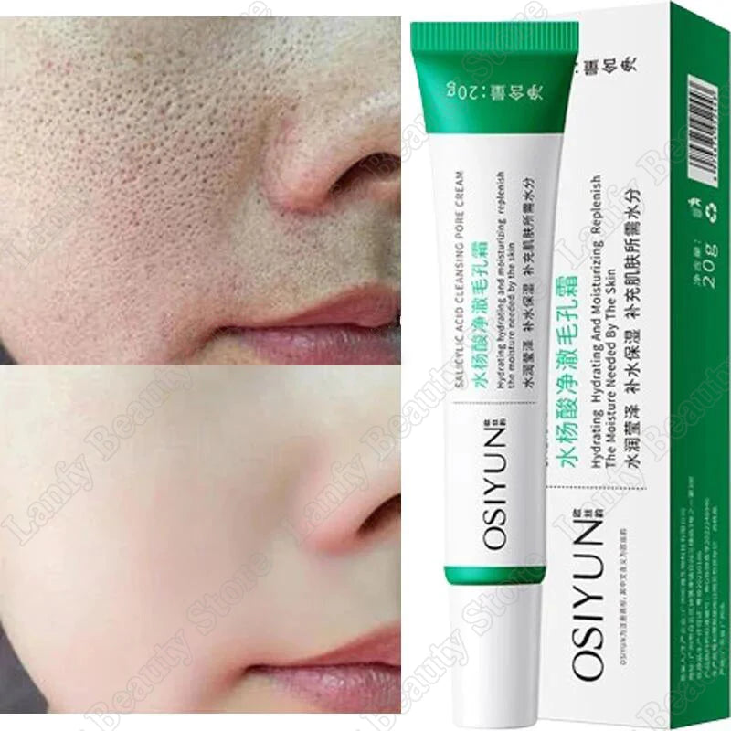 Salicylic Acid Pore Clearing Cream